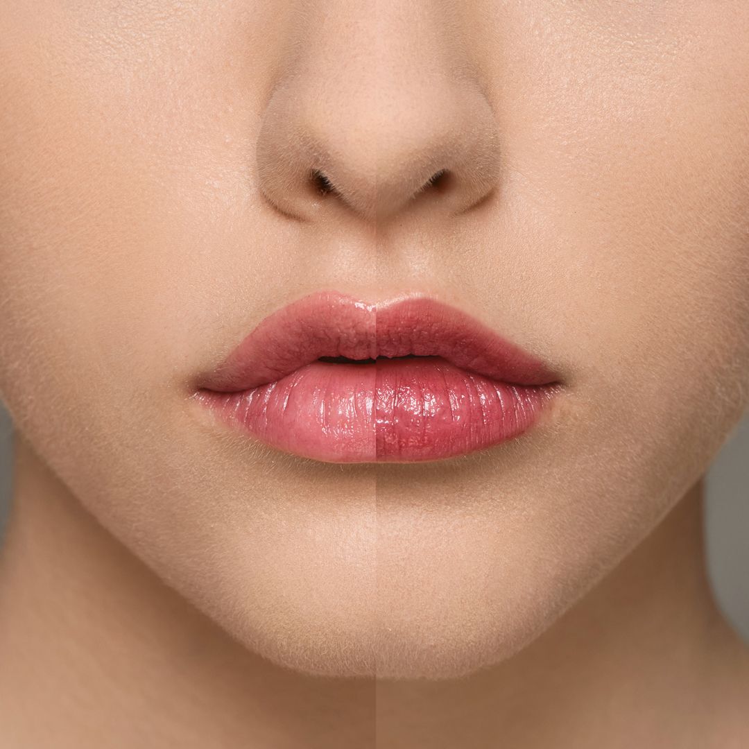 Supreme Lip Treatment - Raspberry